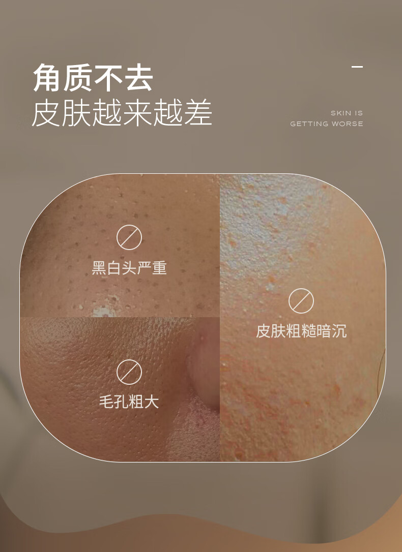 INSRE英国进口去黑头角质死皮面部深层清洁收缩毛孔男女士洁面啫喱膏 面部去角质