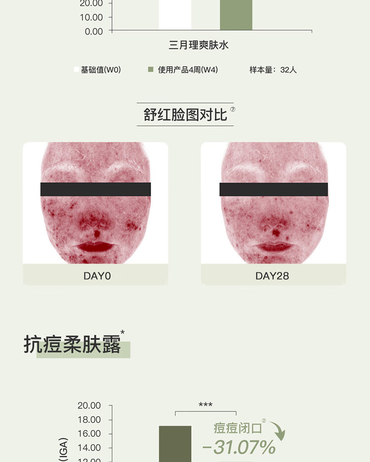 三月理 油痘肌水乳红茶控油抗痘套装舒缓清爽平衡水油补水学生男女 控油祛痘水乳2件套