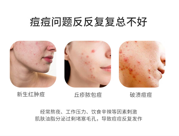 皮宝点痘精华舒缓痘敏肌控油缓解痘痘清痘舒缓肌肤温和 点痘精华15g