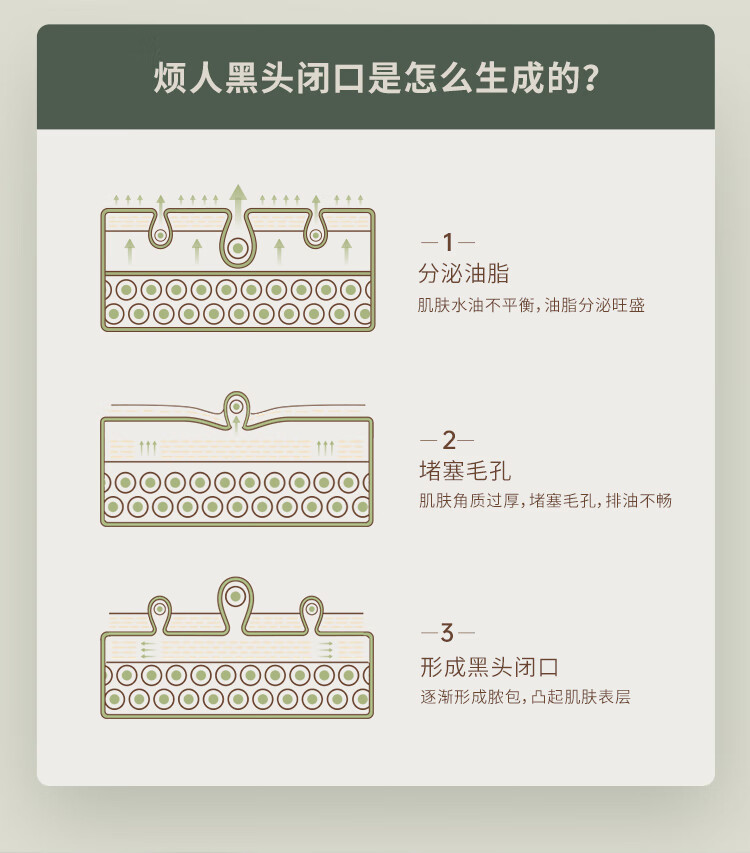 雾屿森林水杨酸棉片洁净闭口粉刺黑头毛周角化温和净痘印（1%日常水杨酸） 3盒180片【顽固痘肌必囤】