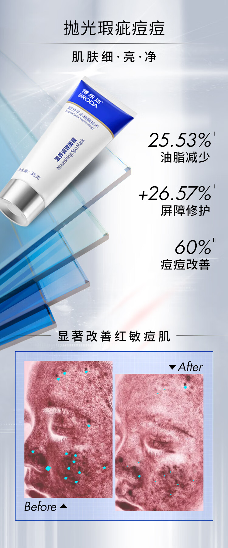 博乐达水杨酸清痘去痘去黑头去闭口粉刺痘印清洁控油凝胶35g面膜