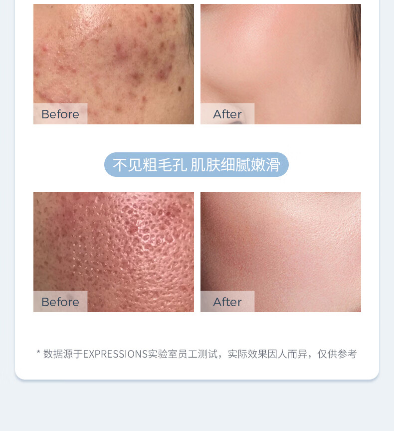 EXPRESSIONS新加坡进口氨基酸除螨洗面奶控油祛痘去黑头收缩清洁毛孔洁面乳 氨基酸洁面乳120g