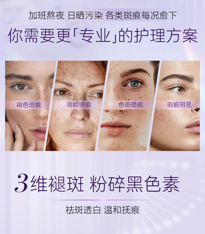 RSAS祛斑美白精华 雀斑老年斑晒斑黑斑黄褐斑 淡化斑点黑色素提亮肤色 祛斑美白精华30ml