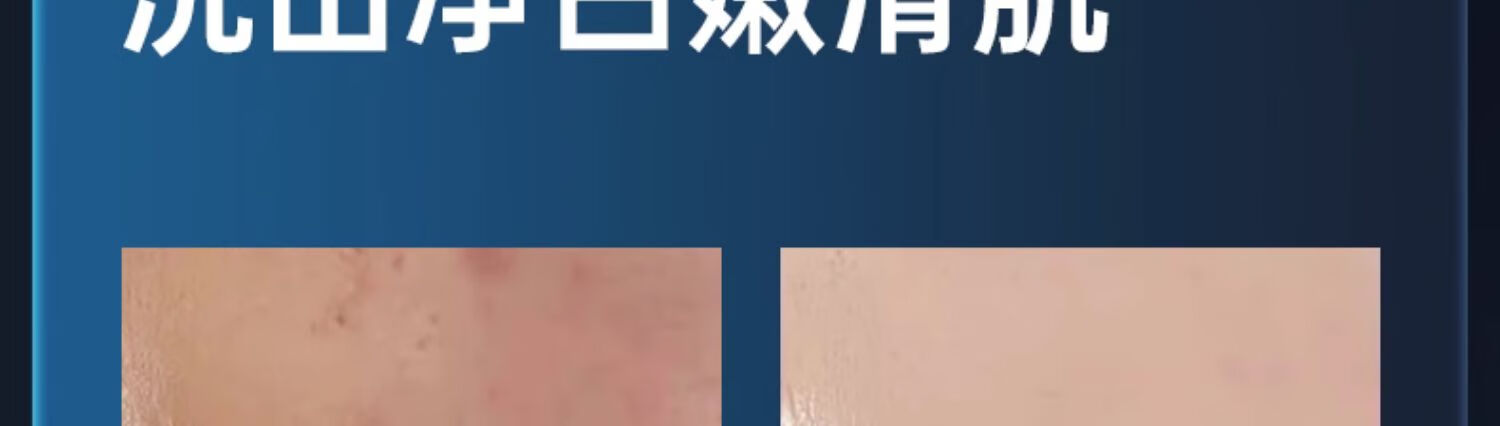 仁和匠心植萃祛痘控油洗面奶男女温和清洁祛痘修护改善痘印舒缓肌肤 植萃祛痘控油洗面奶150g*1
