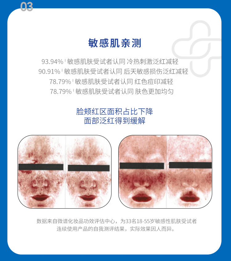 皮宝舒缓修护精华液敏感肌面部精华肌肤屏障维稳保湿小蓝瓶护肤品 精华液30ml*1