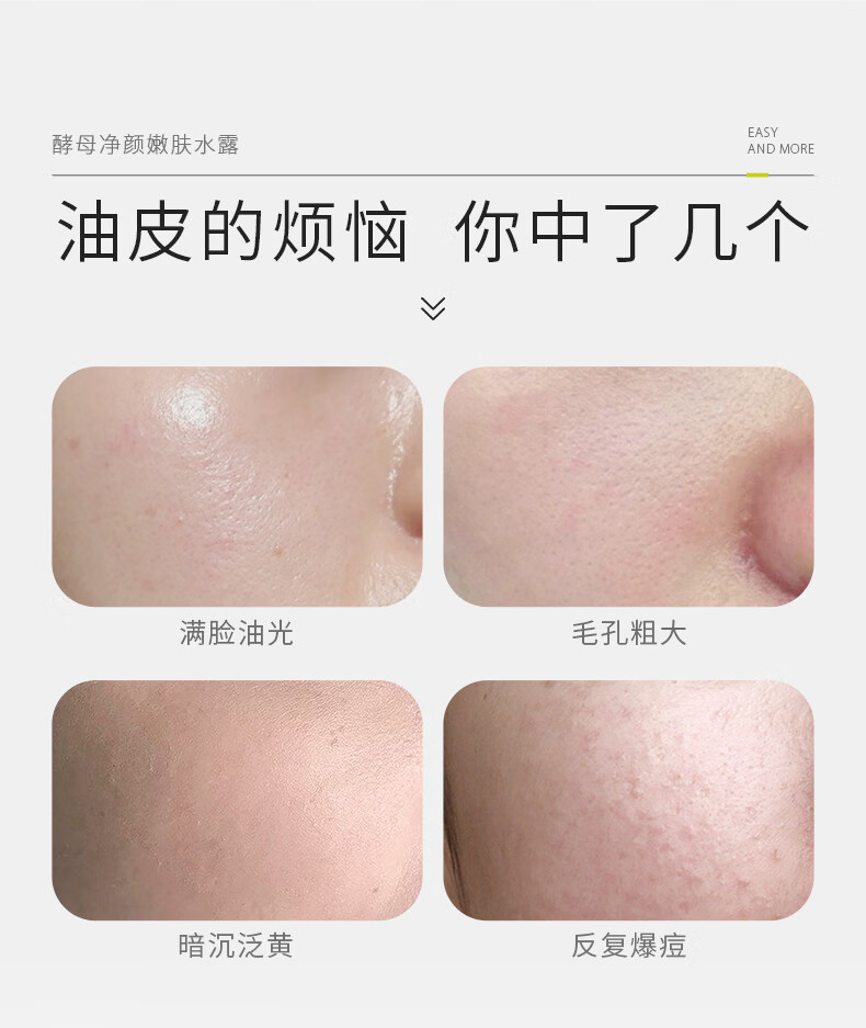 934酵母控油护肤套装水乳清爽补水收敛毛孔943男女适用 【进阶2.0】慕斯+酵母嫩肤水+露