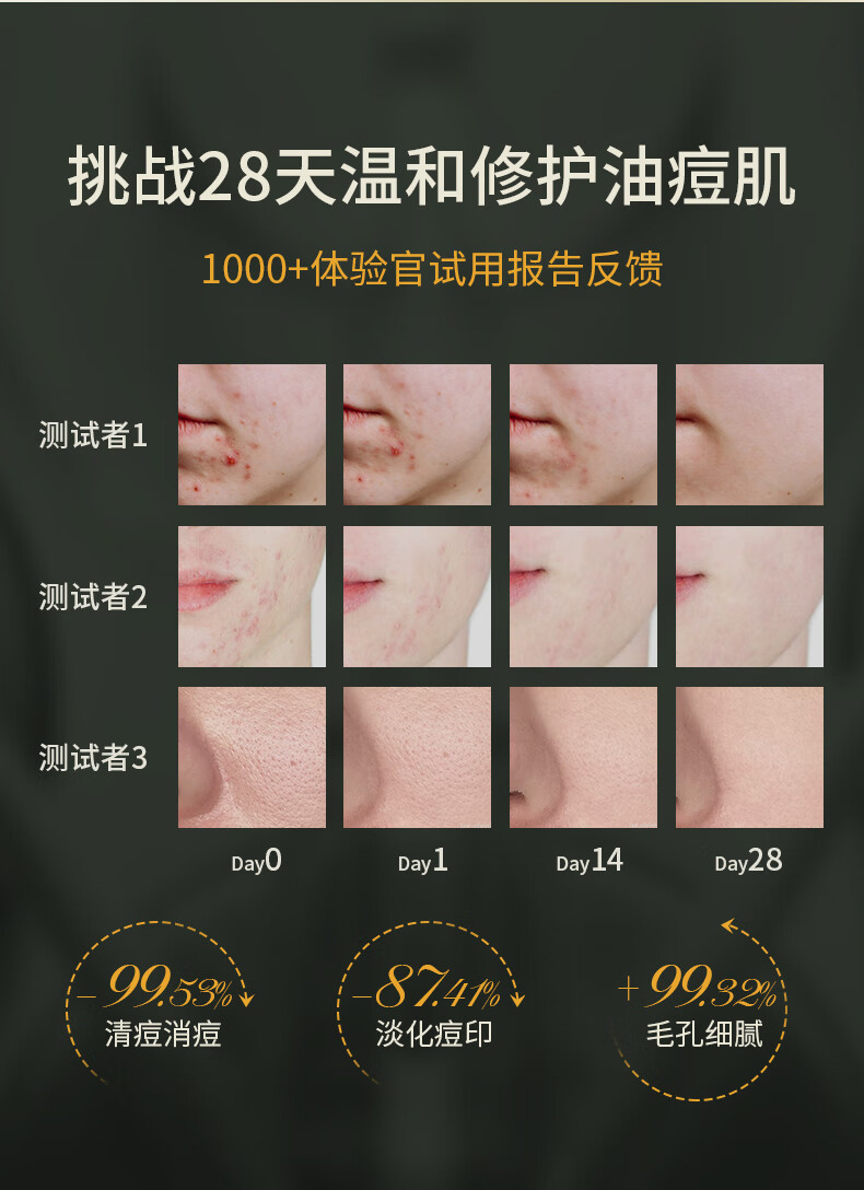 SKISGEM原装进口水杨酸祛痘精华液淡化痘印痘坑修复控油收缩毛孔男女士 【祛痘淡印】水杨酸精华液30ml