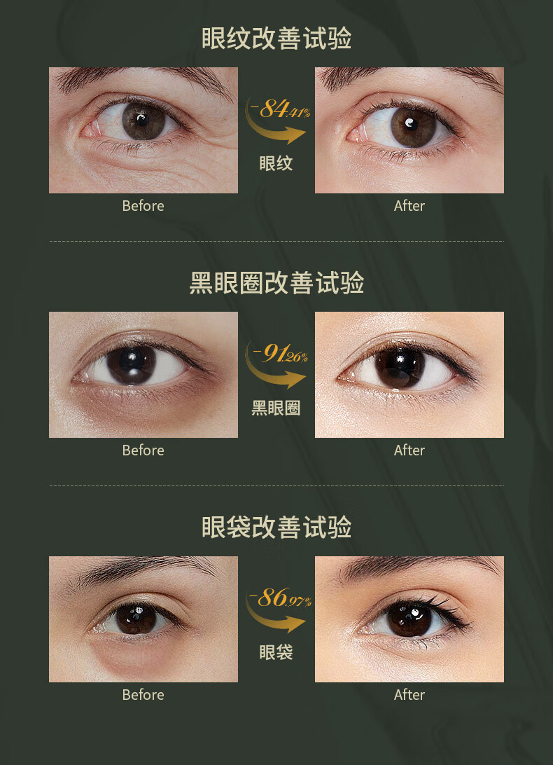 SKISGEM原装进口眼霜改善黑眼圈眼袋淡化细纹抗皱紧致眼周护理男女士 【97%顾客选】改善重度眼圈60g