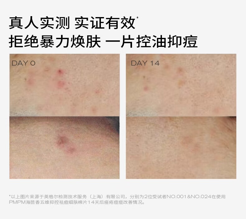 PMPM海茴香祛痘细肤棉片改善闭口粉刺黑头清洁棉片湿敷 1瓶（50片）