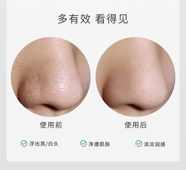 柏翠丝（Bytree's） 茶树去黑头套装清洁收细毛孔黑头收割机闭口精华鼻贴