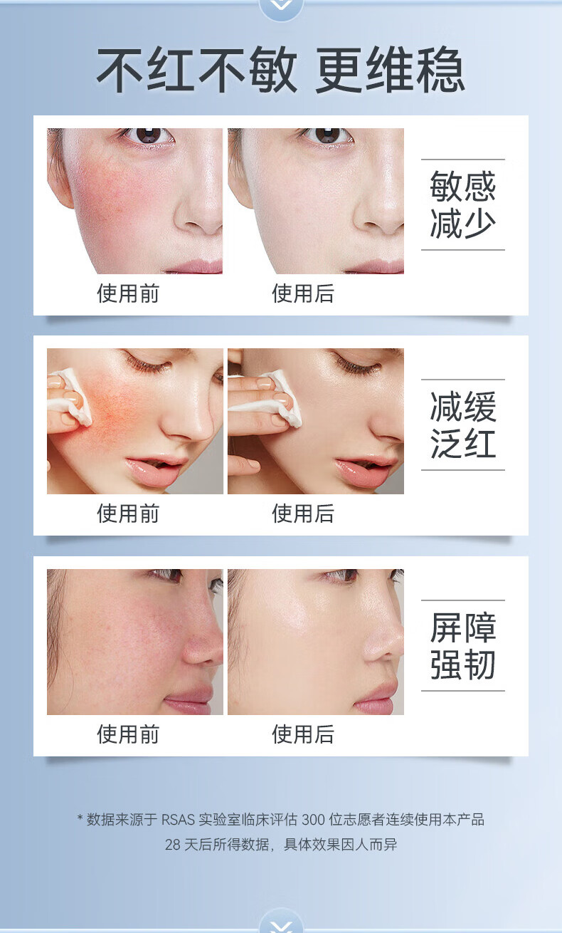 RSAS 舒缓精华 红血丝修复角质层修护屏障 敏感肌专用护肤品 舒缓保湿倍护霜30g