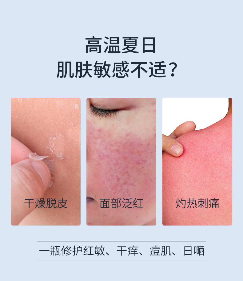 SUMDOY 日本进口晒后修复芦荟胶急救凝胶全身体皮肤屏障脸部晒黑伤修护 200g（舒缓深层修护）
