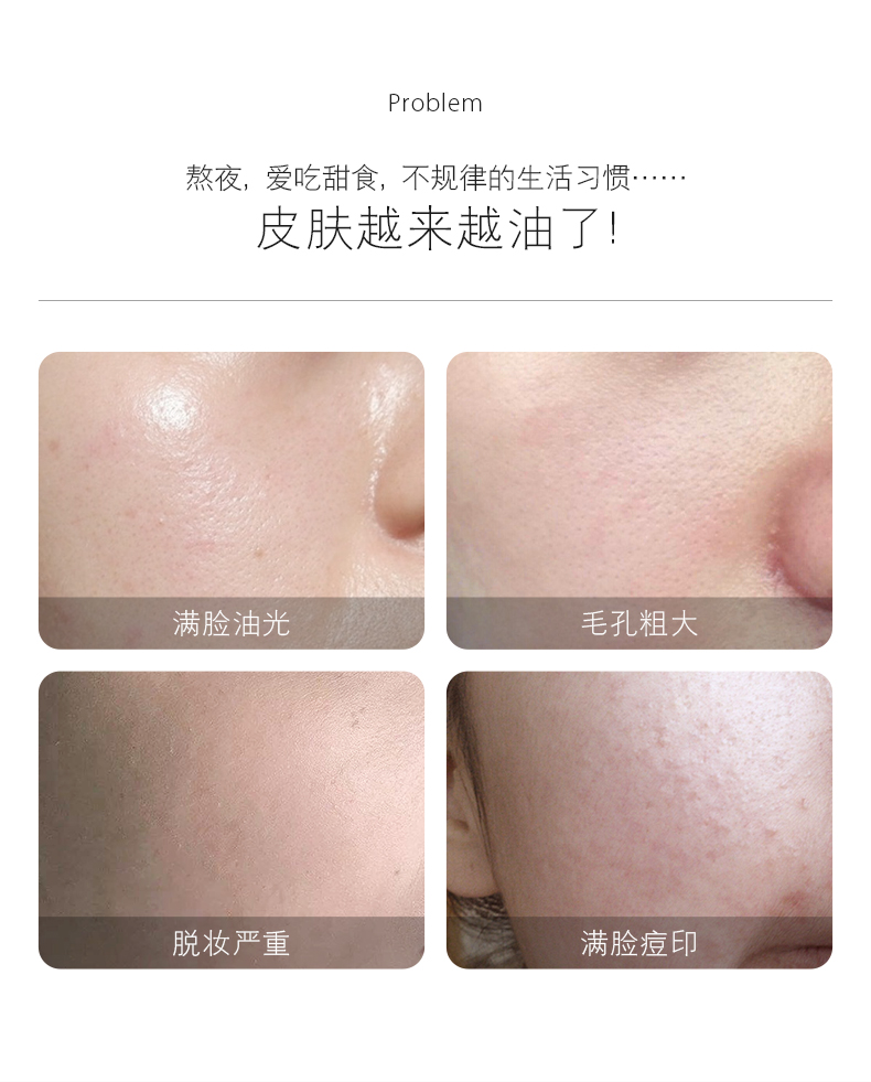 934酵母调理露清爽润肤乳补水保湿控油收敛毛孔943男女适用 【1瓶】100ml