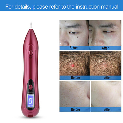 Greensen LCD Screen Spot Removal Pen USB Freckle Spot Mole Tattoo Removal Pen Skin Repair Beauty Machine
Greensen LCD Screen Spot Removal Pen USB Freckle Spot Mole Tattoo Removal Pen Skin Repair Beauty Machine