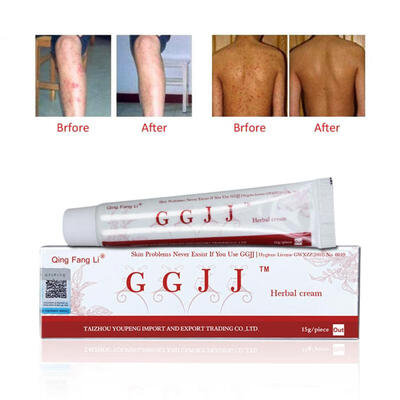 Psoriasis Cream Body Massage Patches Anti Eczeem Psoriasis Cream Works Perfect Relieve All Skin Problems For itching patch
Psoriasis Cream Body Massage Patches Anti Eczeem Psoriasis Cream Works Perfect Relieve All Skin Problems For itching patch