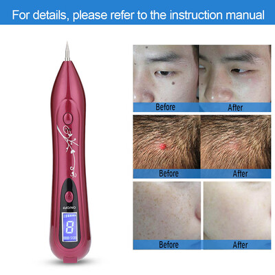 LCD Screen Spot Removal Pen USB Freckle Spot Mole Tattoo Removal Pen Skin Repair Beauty MachineBeauty Machine Freckle Remover
LCD Screen Spot Removal Pen USB Freckle Spot Mole Tattoo Removal Pen Skin Repair Beauty MachineBeauty Machine Freckle Remover