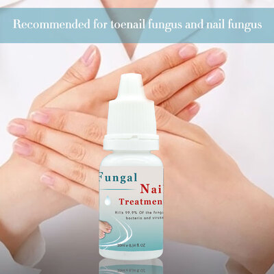 Fungal Liquid Nail Treatment Essence Nail&Foot Whitening Toe Nail Fungus Removal Feet Care Nail Gel For Onychomycosis
Fungal Liquid Nail Treatment Essence Nail&Foot Whitening Toe Nail Fungus Removal Feet Care Nail Gel For Onychomycosis