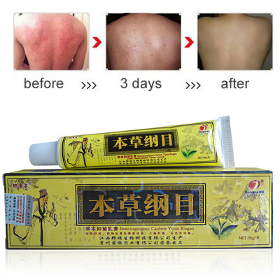 Advanced Body Psoriasis Cream Perfect For Dermatitis&Eczema Pruritus Psoriasis Ointment Herbal Creams
Advanced Body Psoriasis Cream Perfect For Dermatitis&Eczema Pruritus Psoriasis Ointment Herbal Creams