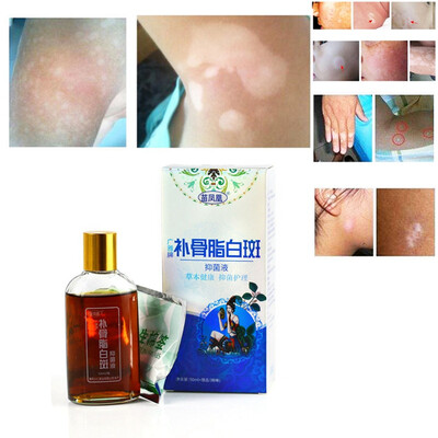 Medical Professional Treatment For Skin White Spot Vitiligo Eczema Sweatstain Solution
Medical Professional Treatment For Skin White Spot Vitiligo Eczema Sweatstain Solution
