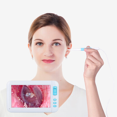 P20 Ear Spoon Endoscope 43 Large Screen Otoscope 55mm Diameter Lens 6PCS LED 1080P HD Camera Visual Earpick Inspection Earwax
P20 Ear Spoon Endoscope 43 Large Screen Otoscope 55mm Diameter Lens 6PCS LED 1080P HD Camera Visual Earpick Inspection Earwax