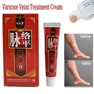 Varicose Veins Treatment Cream Ointment Vasculitis Phlebitis Angiitis Inflammation Blood vessel Rotten legs Varicose Veins Cream
Varicose Veins Treatment Cream Ointment Vasculitis Phlebitis Angiitis Inflammation Blood vessel Rotten legs Varicose Veins Cream