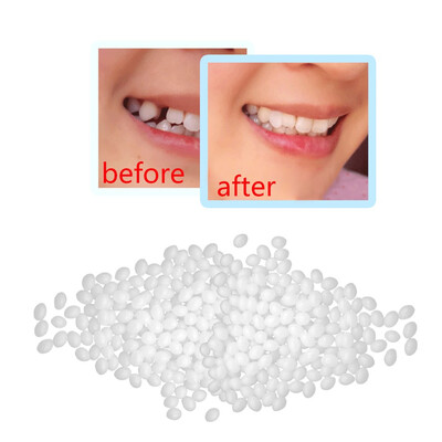 〖Follure〗Temporary Tooth Repair Kit Teeth And Gaps FalseTeeth Solid Glue Denture Adhesive
〖Follure〗Temporary Tooth Repair Kit Teeth And Gaps FalseTeeth Solid Glue Denture Adhesive