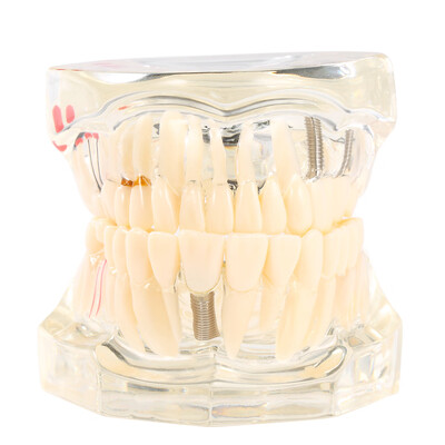 TransparentColored Teeth Learners Tool Adult Typodont Removable Teeth Model for Dentist And Children
TransparentColored Teeth Learners Tool Adult Typodont Removable Teeth Model for Dentist And Children
