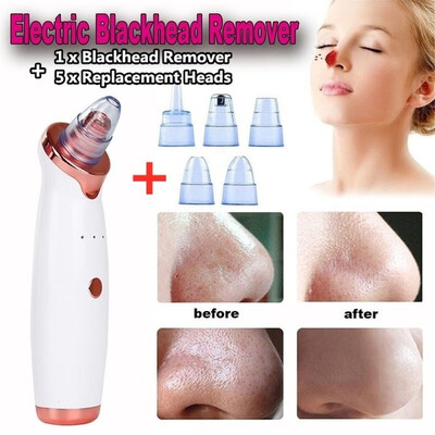 Willstar 2020 Newest Professional Blackhead Vacuum Acne Cleaner Pore Remover Electric Skin Facial Cleanser Kit
Willstar 2020 Newest Professional Blackhead Vacuum Acne Cleaner Pore Remover Electric Skin Facial Cleanser Kit