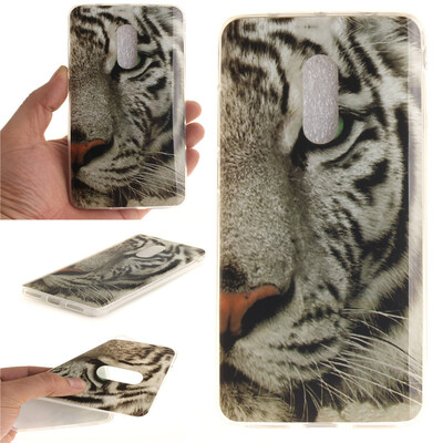 White Tiger Pattern Soft Thin TPU Rubber Silicone Gel Case Cover for XIAOMI Note 4