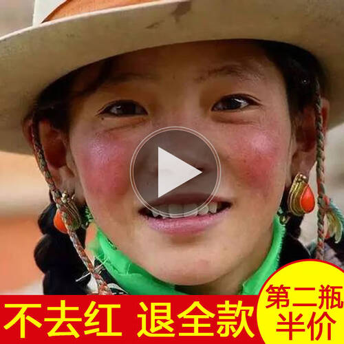 淡化红血丝舒缓温润精华液改善过敏感肌肤修复增厚角质层缓解红肿干痒红鼻子酒糟鼻
