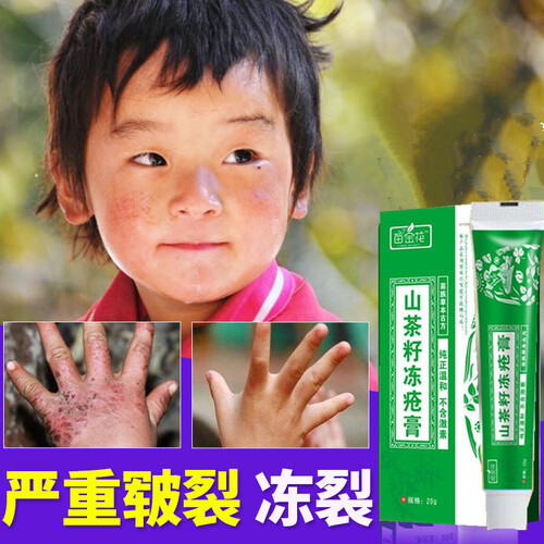 苗金花七手足皲裂膏手安裂脚裂口堂夫宁堂冻永安手脚开裂龟裂脚后跟脚干裂脱皮皲修复霜护脱皮