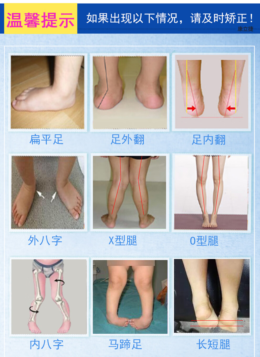 康立捷 定做儿童宝宝足外翻矫正鞋x型腿o型腿内八字脚