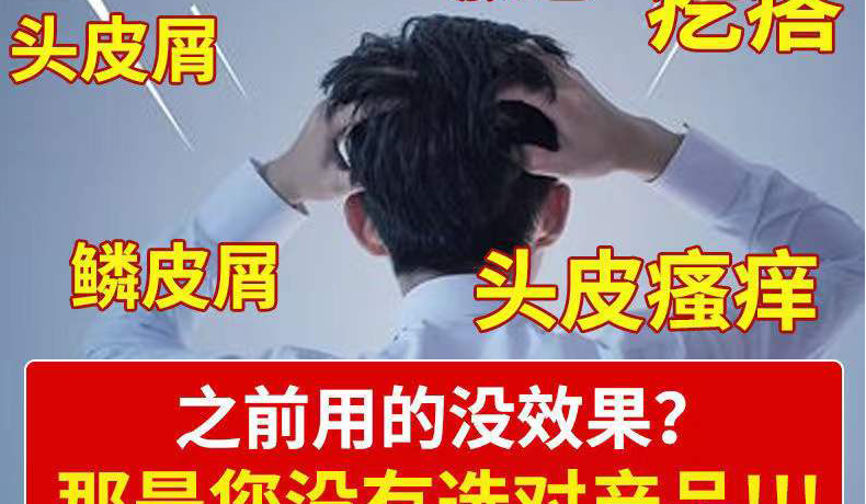 悠妮丝去屑悠妮丝除螨洗发皂深层除螨止痒去屑洗发水控油持i久留香