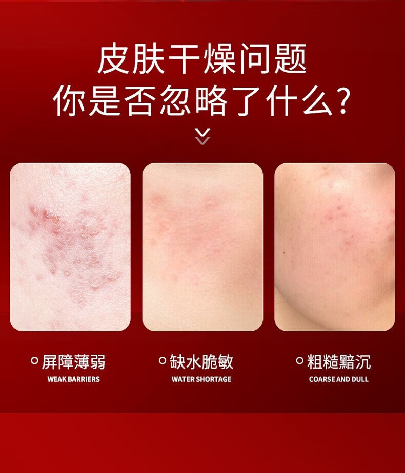 SIKN护肤品套装水乳礼盒多肽胶原蛋白补水保湿女士化妆品全套节日送礼 胶原蛋白五件套