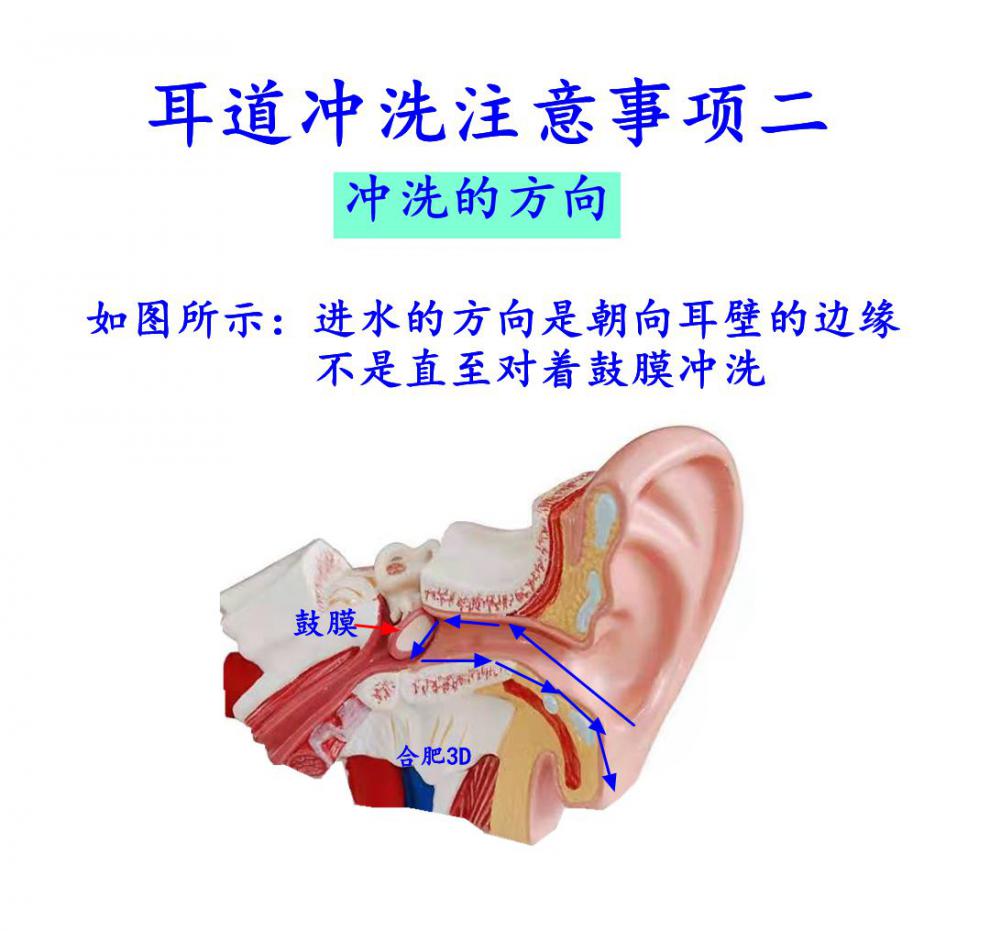 耳朵清洗器洗耳朵耳道冲洗器洗耳器冲洗耳朵采耳店洗耳朵家用冲洗耳道
