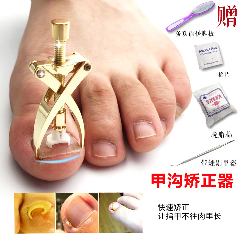 脚趾甲矫正器 修脚刀