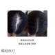 Hair Growth Liquid Aveda Scalp Hair Growth Essence Activating Care Essence 150ml Conditioner Tax Free Huge Discount! Hurry up! Others 150ml Hair Growth Liquid Aveda Scalp Hair Growth Essence Activating Care Essence 150ml Conditioner Tax Free Huge Discount! Hurry up! Others 150ml