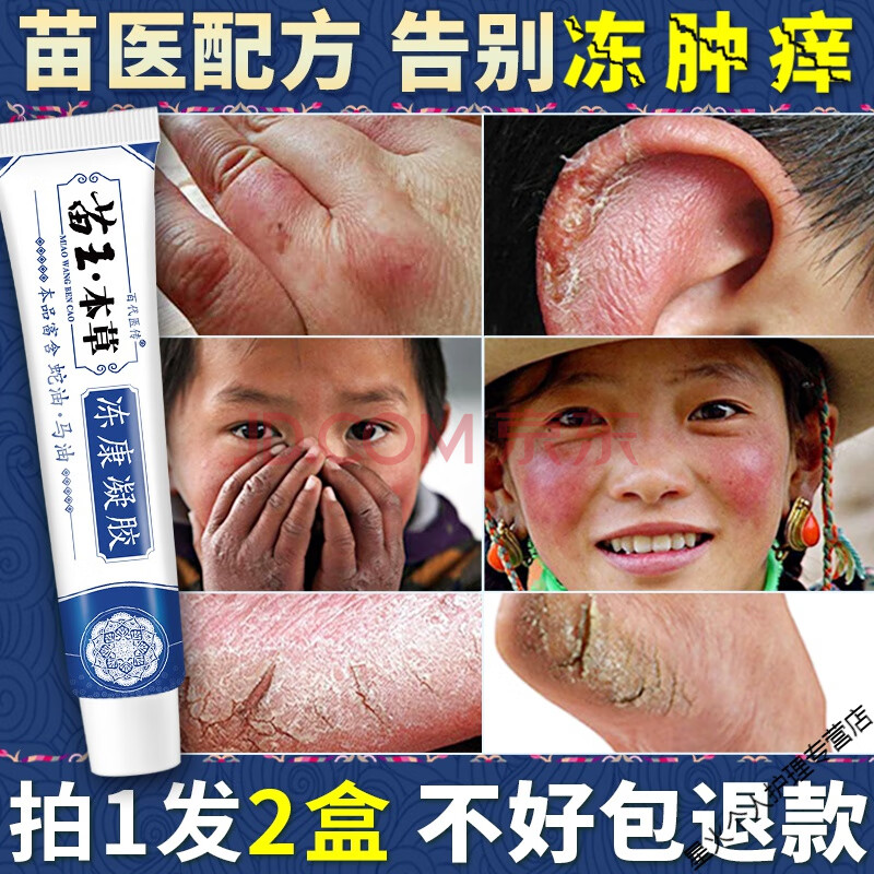 冻伤膏消肿防冻红冻肿冻裂干裂治根手耳朵脸部脚手部神s器防裂儿童霜
