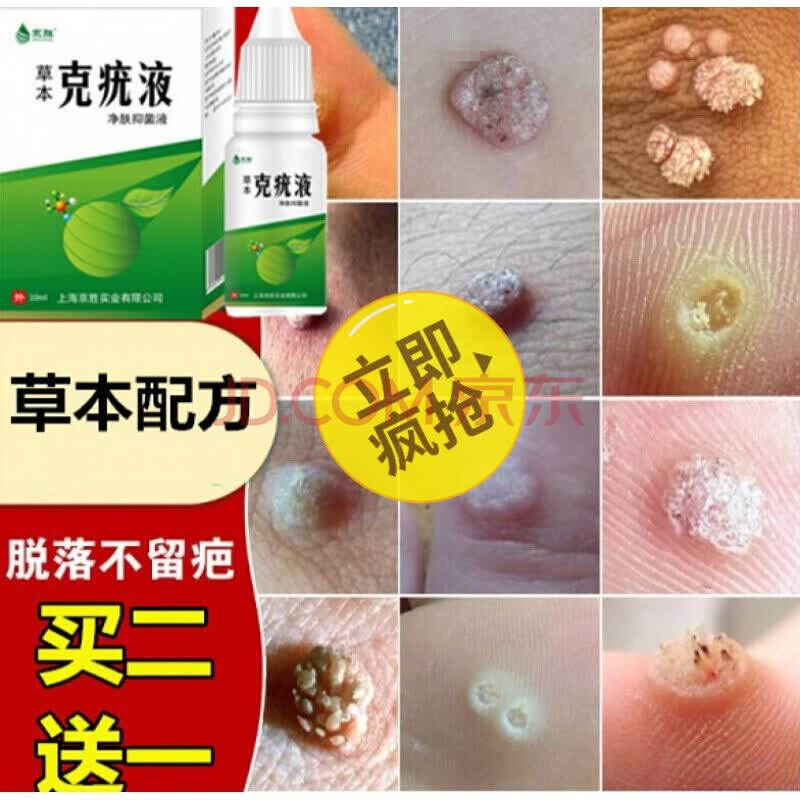 瘊i子肉i刺鸡i眼去猴i子肉粒i疙i瘩去除膏刺猴跖i疣的