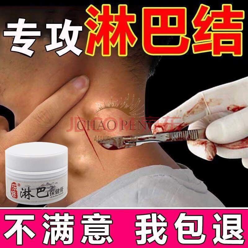 淋巴消除神i器脖子下巴淋巴结核淋巴腺肿大炎消淋巴消除散结膏 买3 2