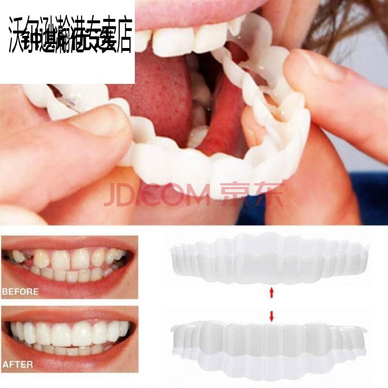 假牙套仿真大门牙临时美白遮牙套遮盖假牙齿缺牙牙洞套缺陷修复 上牙