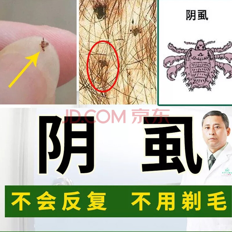 祛虱百部酊去阴虱除虱子头虱灭虫卵成人用灵喷剂虱立净杀跳蚤清虱露