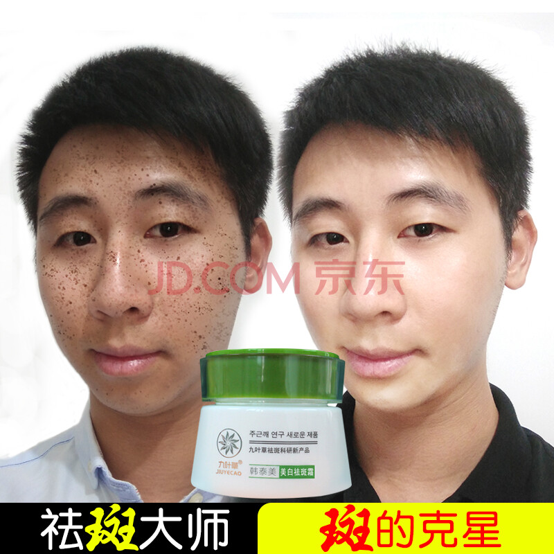去斑补水保湿男女学生去黄黑褐斑雀斑遗传斑晒斑老年斑护肤去斑膏产品