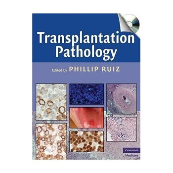 transplantation,scientia transplantation pathology (cambridge medicine)(book cd-rom)