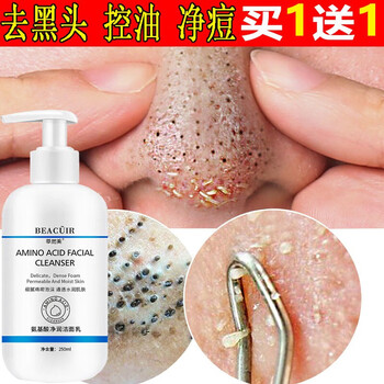 碱面去黑头粉刺方法_激光祛痘痘粉刺方法_去粉刺的方法