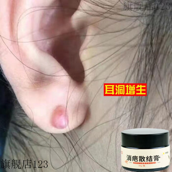 瘢痕疤痕体质祛硬肉疙瘩凸起增生剖腹产胸前手术耳洞疤痕膏蟹足肿一瓶