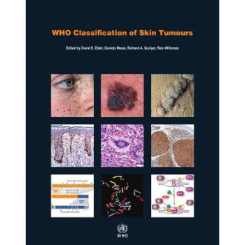 ֻ ֯Ƥ WHO Classification of Skin Tumours