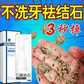 不洗牙去结石去牙黄牙结石牙垢溶解清除牙斑茶渍口臭洗牙神器购3加2