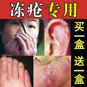 时通 冻疮膏止痒冻疮消防冻霜防开裂膏冻手霜脸部耳朵脚冻伤消膏冻疮