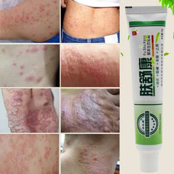 余氏堂 肤舒康草本生态乳膏 成人慢性湿疹膏皮炎肛门肛周阴囊瘙痒牛皮